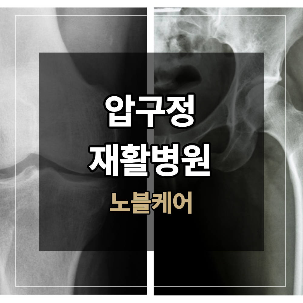 압구정 재활병원 고관절 수술 후 언제 부터 걸을 수 있나요?